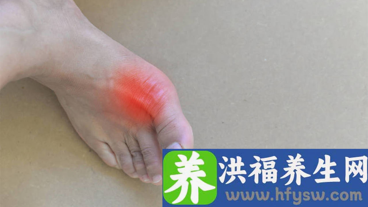 尿酸高能喝黄酒吗
