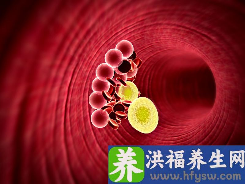 橙子是高血脂的“催命符”吗？想降血脂，养成3个饮食习惯