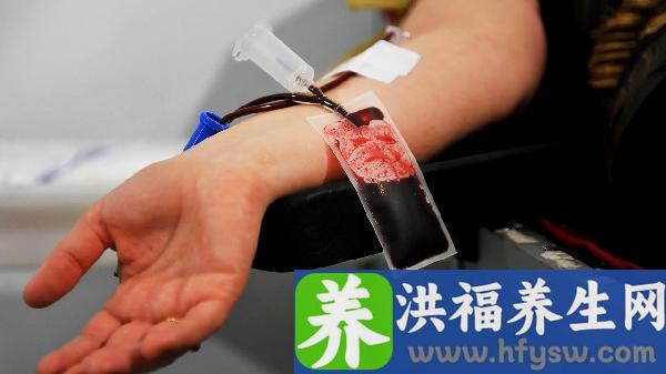 体检血脂异常能自行恢复吗