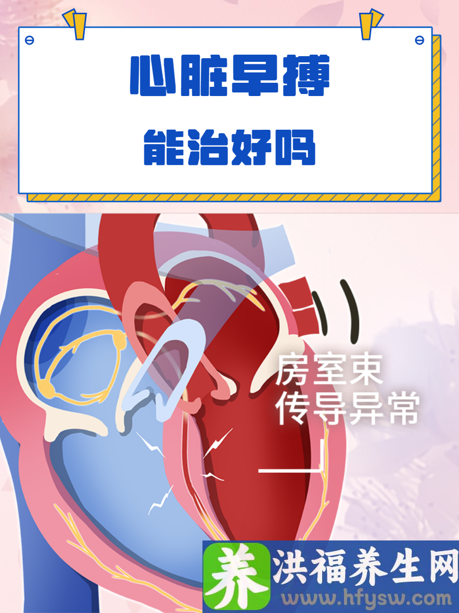 心脏早搏能治好吗？经常早搏人群需了解