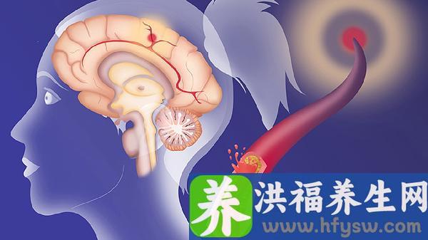 血压高脑血管堵塞吃什么食物好