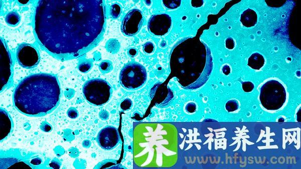病毒合并细菌感染血常规特点