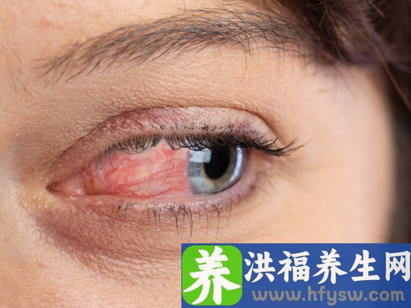 习惯揉眼睛？警惕：这种眼病要小心
