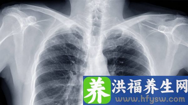 支原体白肺能恢复正常肺吗