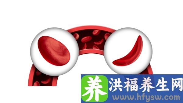 白蛋白27严重吗
