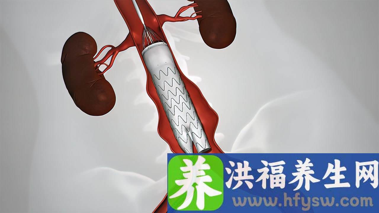 主动脉瓣狭窄有哪些症状