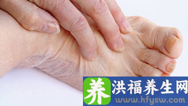 系统性红斑狼疮与雌激素有关吗