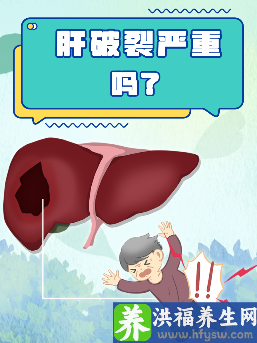 肝破裂严重吗？这些知识一定要了解