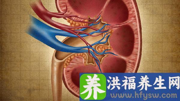肾结石导致的腰疼症状怎么办