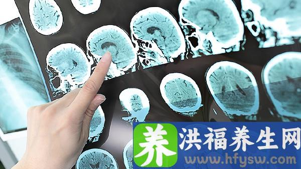 血液黏稠怎么办比较好