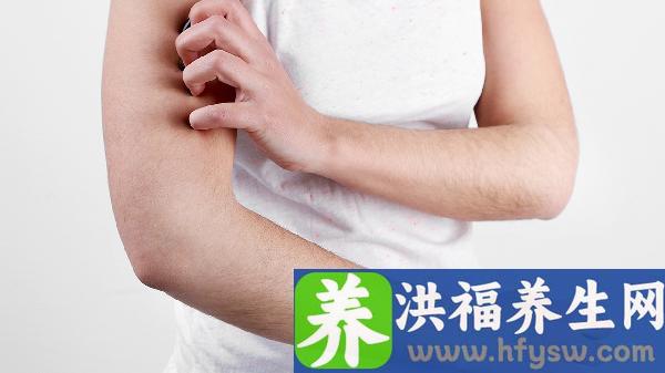 春季皮肤过敏5大治疗方法：从中药到光疗，轻松缓解瘙痒红肿