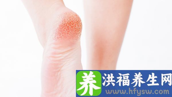 足后跟底部疼痛用什么药
