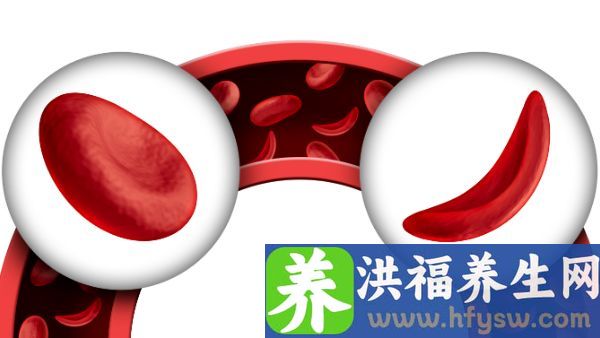 贫血可以吃大蒜炒菜吗