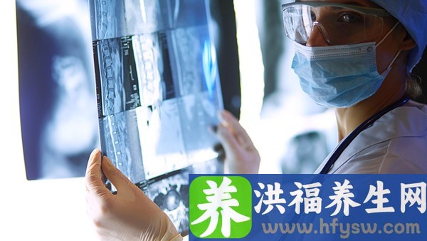 女性尖锐湿疣怎么办？带您认识女性尖锐湿疣的症状表现
