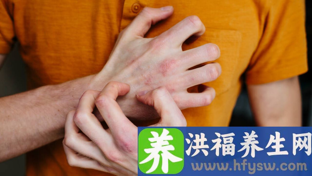 未分化型结缔组织病严重吗