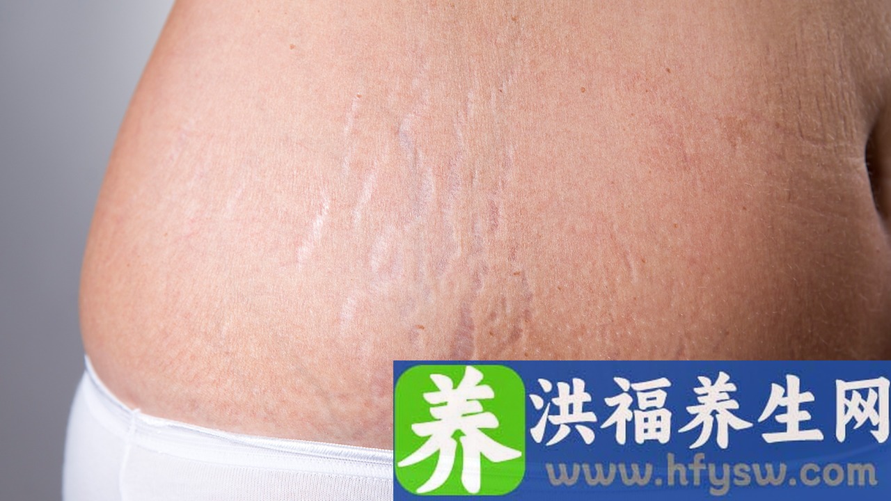 妊娠异位是什么意思？ 怀孕初期1-7天症状