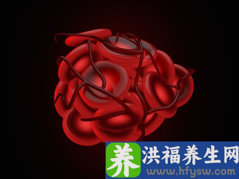 这4个部位出现疼痛，可能是“血栓”前兆！4类人要格外注意