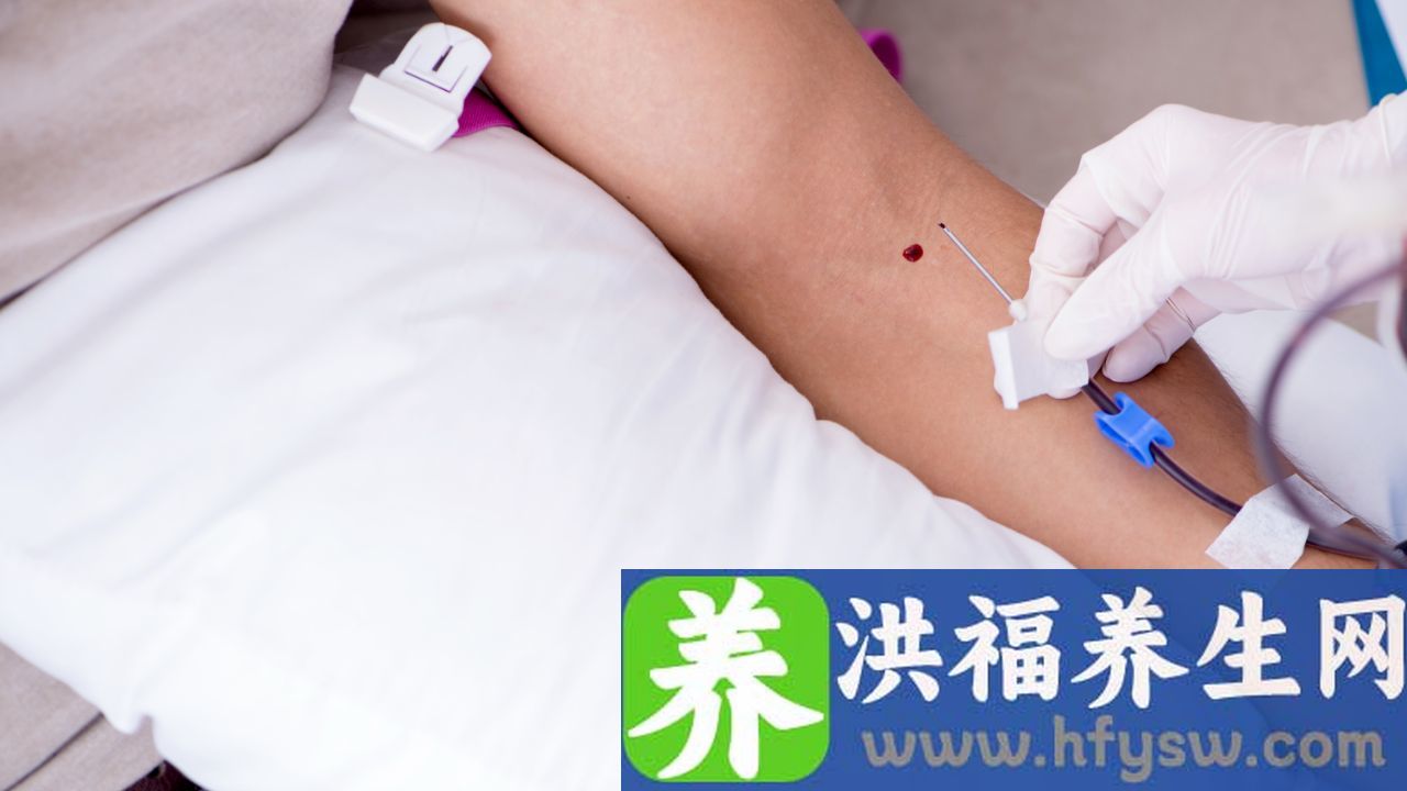 输血反应有哪四种
