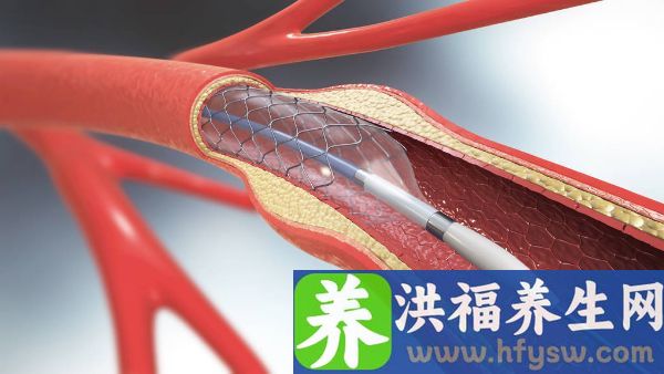 血液病都有哪些症状呢