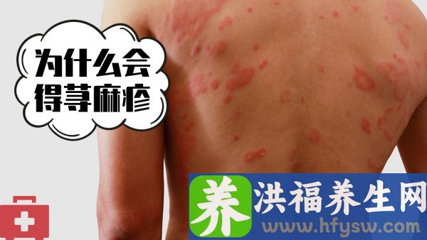 生殖器疱疹能不能治根