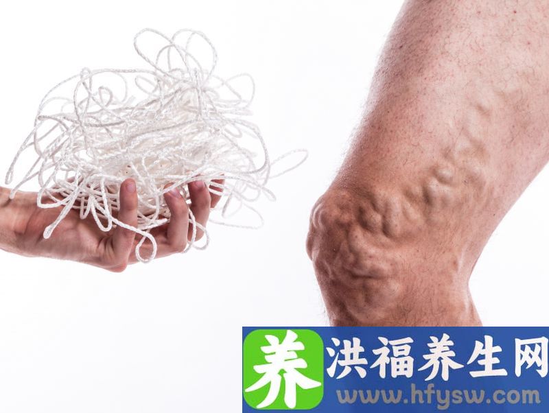 体内有血栓，手脚先知！提醒：这4种表现，提示血管可能堵塞了