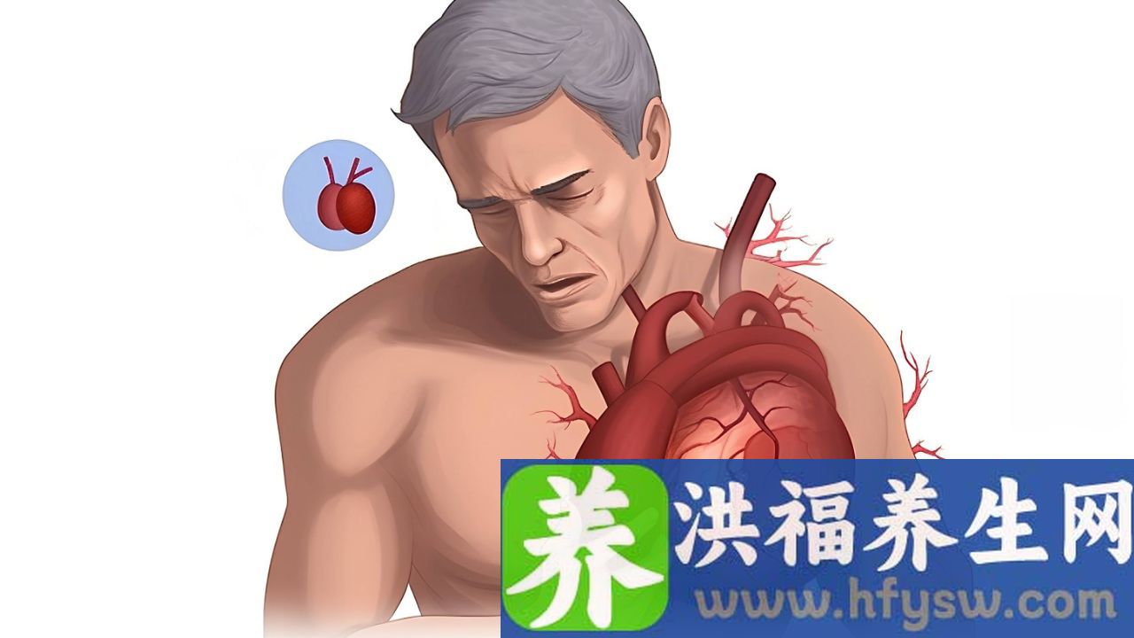 肥厚型心肌病有哪些症状