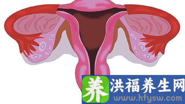三维彩超和四维彩超有什么区别宫腔粘连