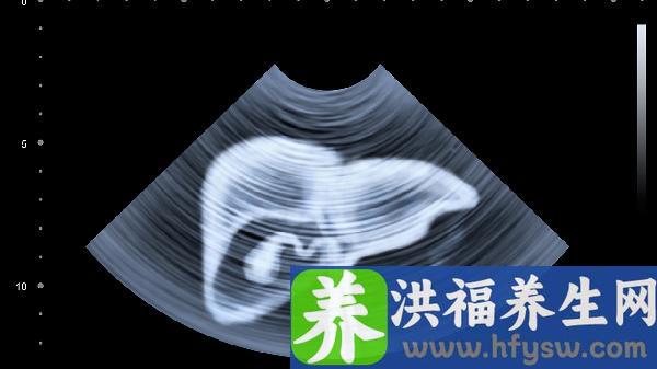 春天吃什么养肝脏好最有效