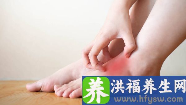 足癣能献血吗