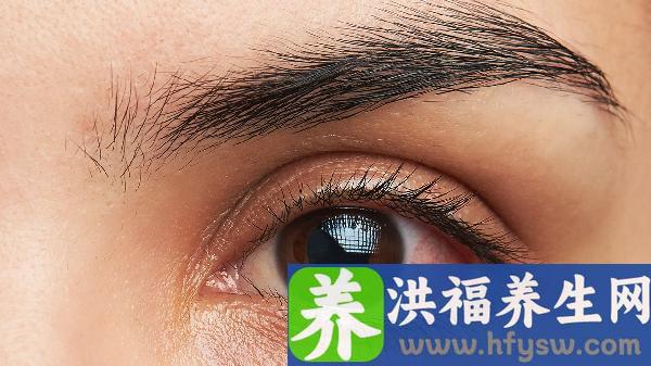 慢性结膜炎和干眼症有区别吗