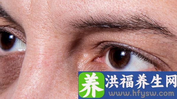 做脉冲光去黑眼圈适合哪些人？