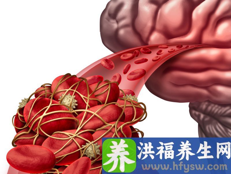 饮食有讲究，吃不对，给血管添麻烦！4种食物少吃，预防脑梗
