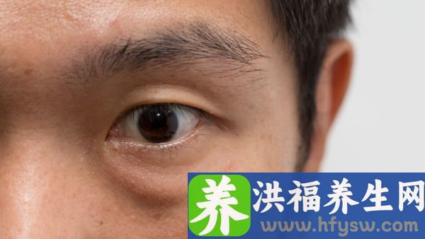面部痉挛的早期症状有哪些