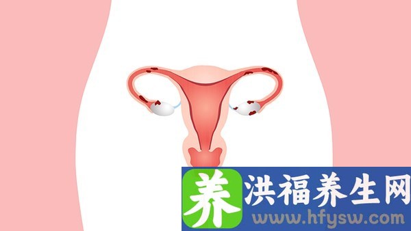 宫腔粘连手术后三个月后还要吃药吗