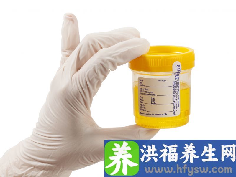 肾病是拖出来的？排尿时出现4种异常，劝你尽早检查一下肾功能