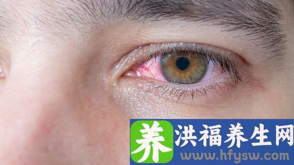 做额部悬吊矫正上睑下垂手术的注意事项是什么？