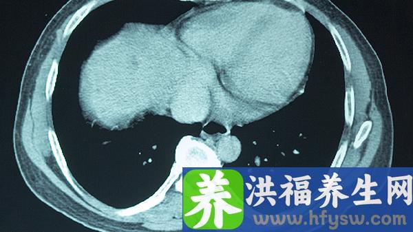 吃什么补充大脑营养提高记忆力效果好