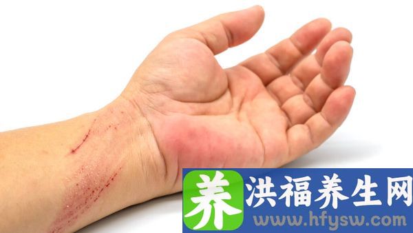 手拇指关节疼怎么回事