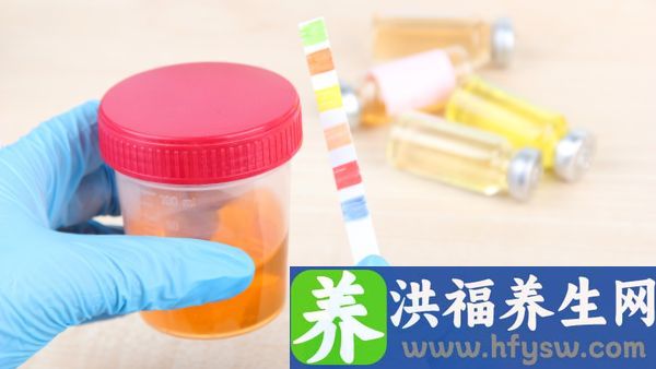 尿液颜色深是什么原因