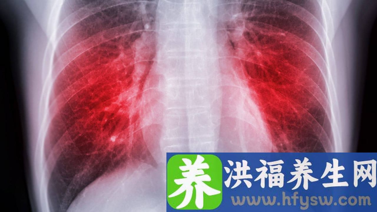 脓胸有哪些临床表现