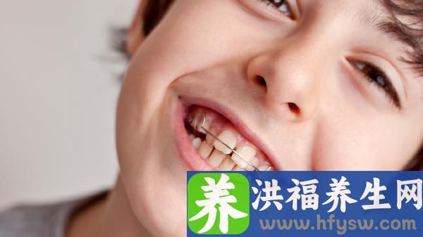 儿童在牙齿矫正期间能喝碳酸饮料吗