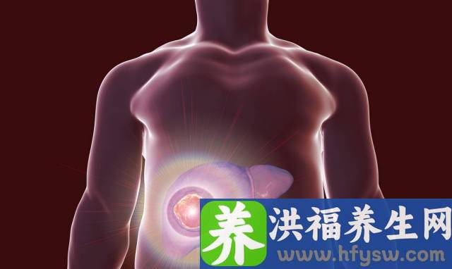 医生坦言：肝硬化“元凶”被揪出，原来和这种水果有直接关系