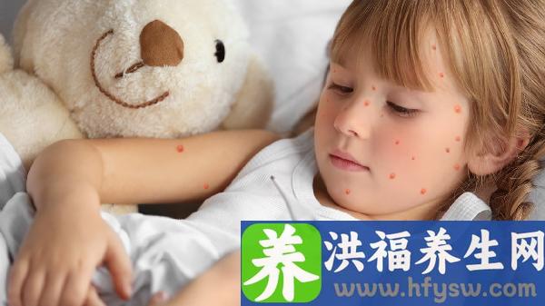 春天荨麻疹频发？5种类型及应对方法全解析，助你轻松应对皮肤困扰