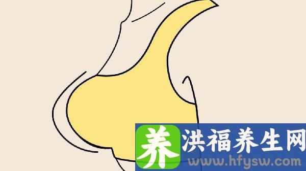 做抽脂缩小巨乳的步骤及注意事项