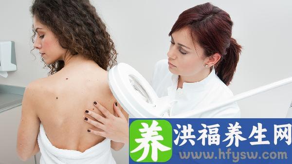 肝病蜘蛛痣长在哪里会痒吗