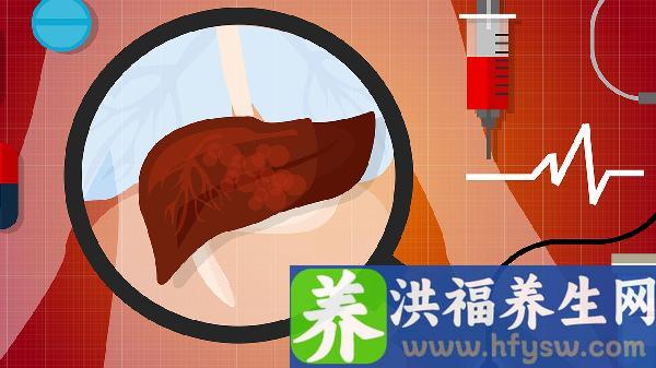 脂肪肝引起的肝炎会传染吗