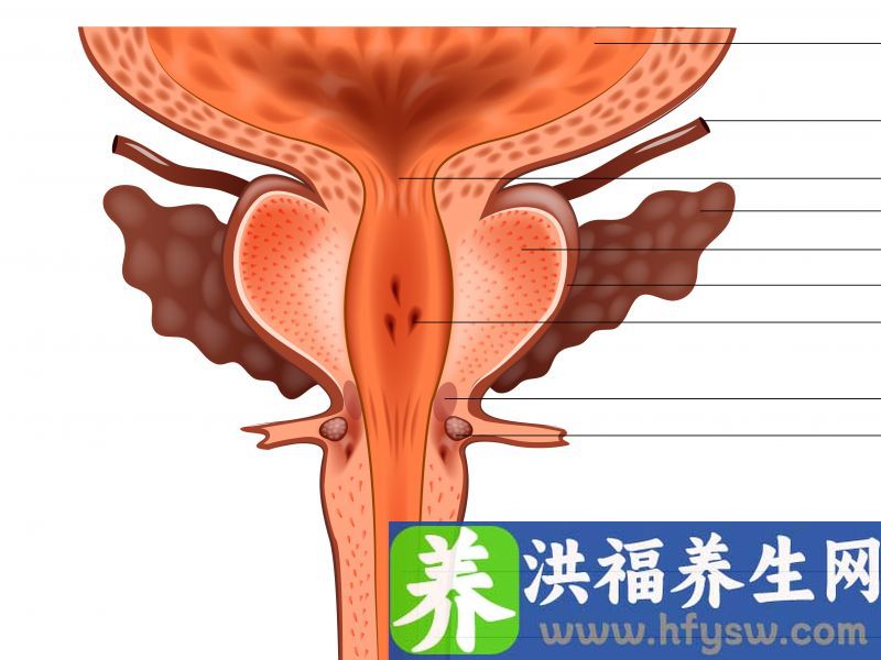 有这4种习惯的男人，前列腺炎最爱“盯”！