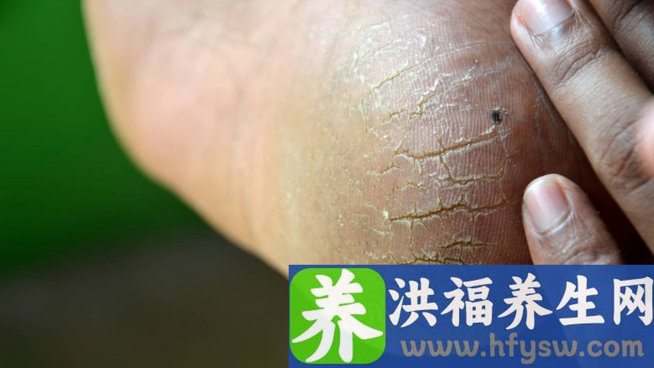 脚掌酸疼是怎么回事