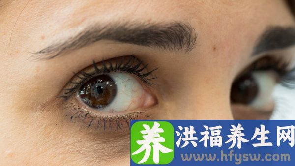 视神经炎的病因有哪些
