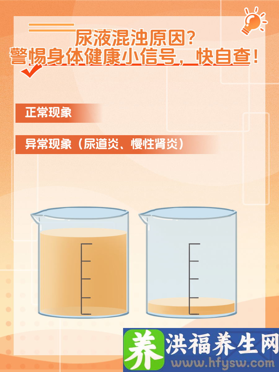 尿液混浊原因？警惕身体健康小信号，快自查